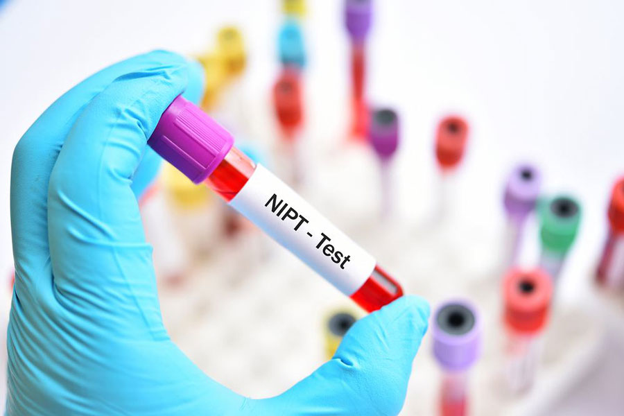 Xét nghiệm NIPT ở đâu Hà Nội