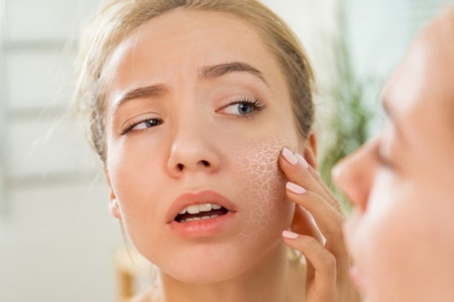 Hạt é là một trong các loại hạt được ưa chuộng của mẹ bầu với tác dụng cải thiện tình trạng làn da khi mang thai