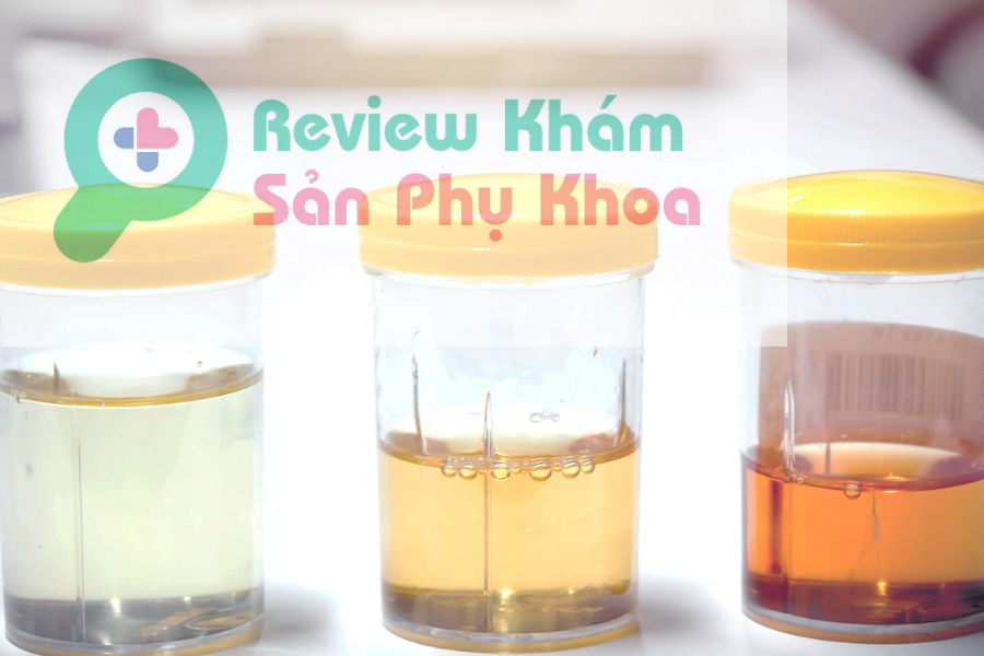 Nước ối có thể trong hoặc hơi đục có thể là dấu hiệu vỡ ối