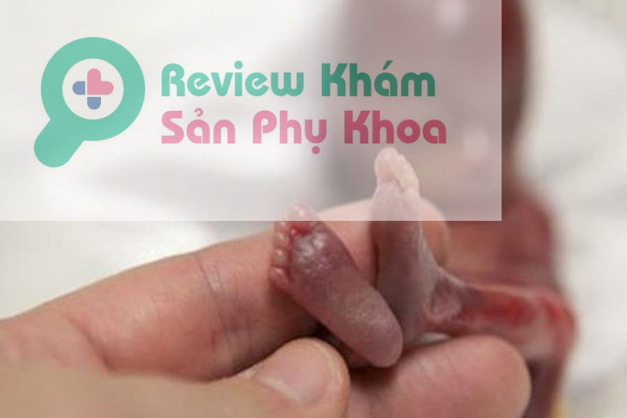 Dấu hiệu sảy thai 4 tuần đầu mà chị em cần biết