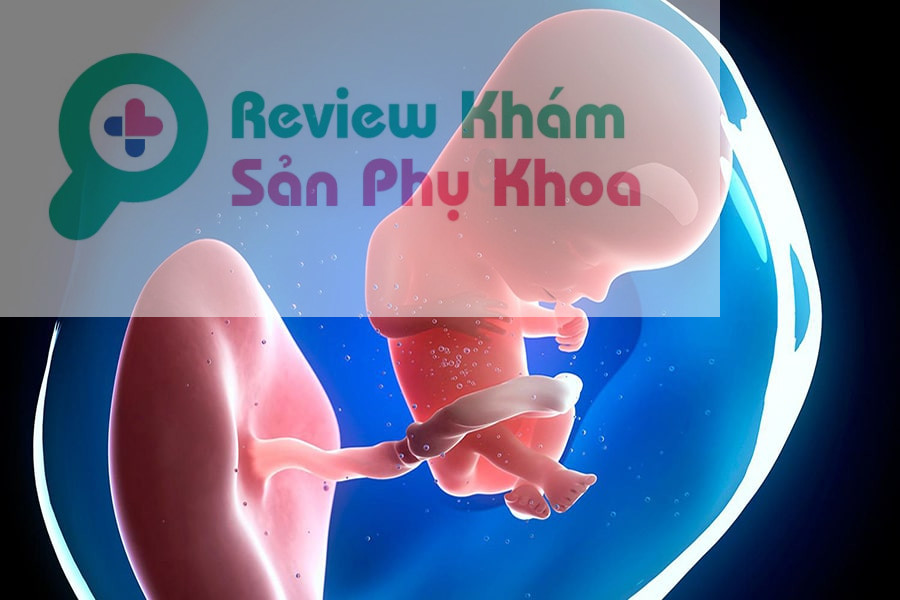 Có nhiều nguyên nhân khác nhau dẫn đến việc lưu thai