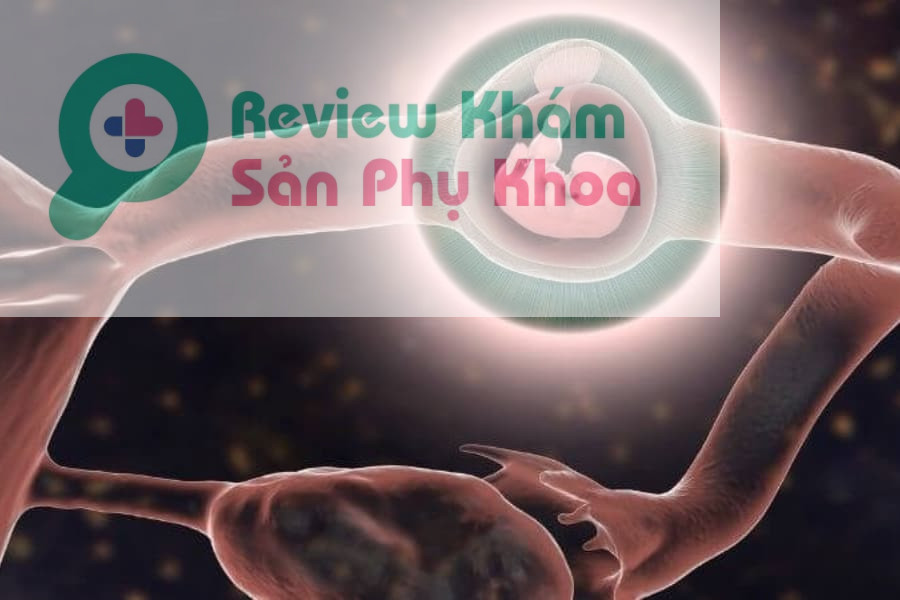 Thai ngoài tử cung là tình trạng cấp cứu sản khoa vô cùng nguy hiểm, đe dọa tới khả năng sinh sản cũng như tính mạng của sản phụ