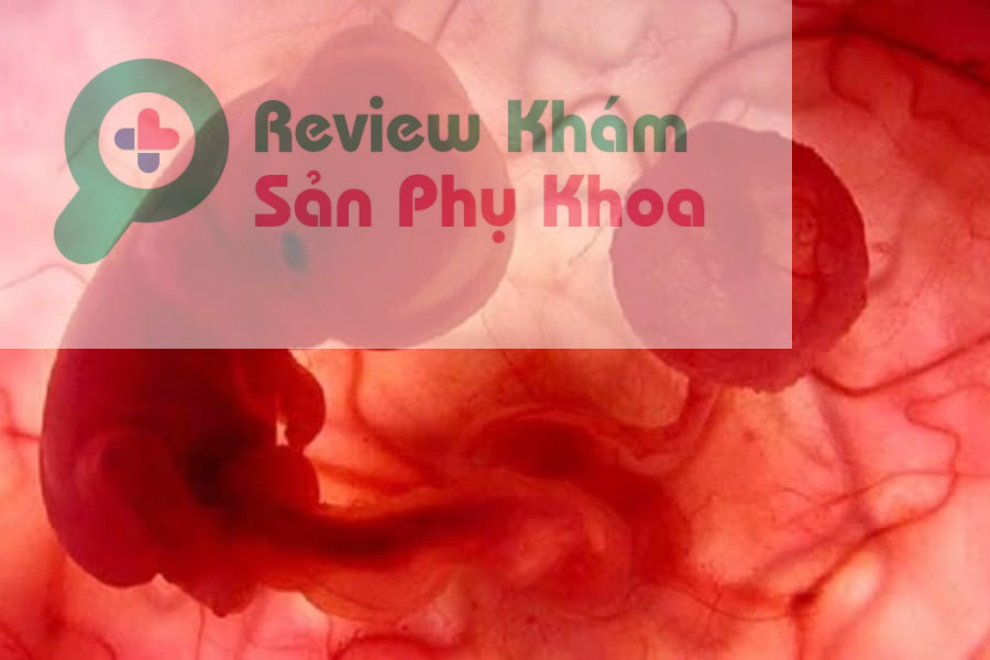 Sự hình thành của tim thai qua từng giai đoạn của thai kỳ