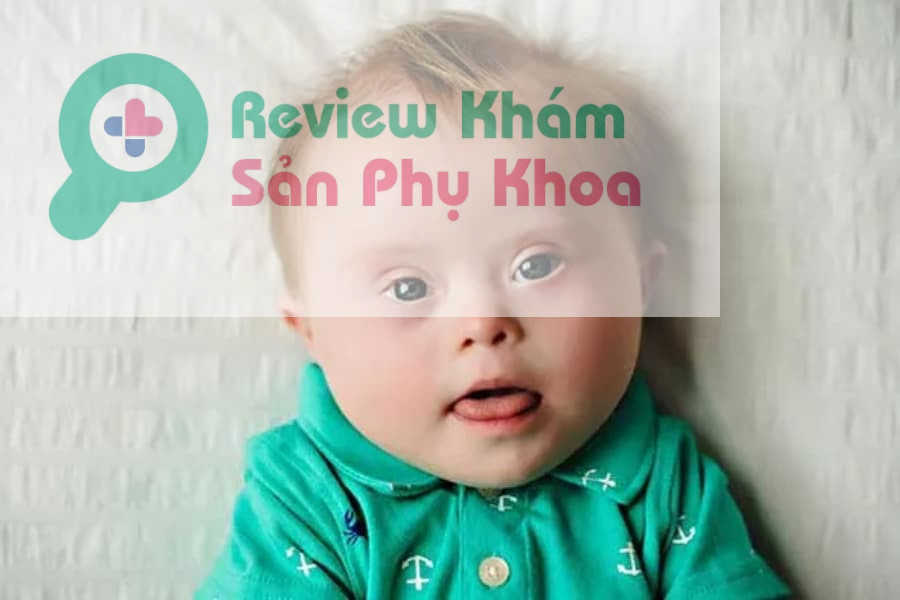 Hình ảnh thai mắc hội chứng down