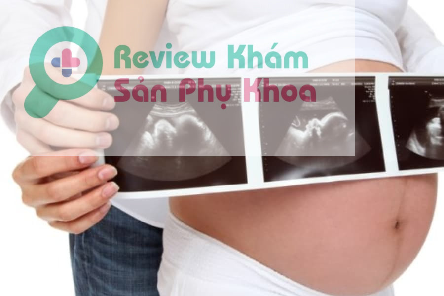 Các mốc thời gian siêu âm mẹ cần nắm rõ để theo dõi tình trạng phát triển của bé yêu