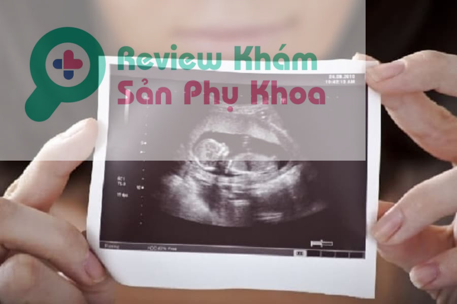 Việc siêu âm 2D phải tuân thủ đúng các mốc khám thai định kỳ theo chỉ định của bác sĩ, để đảm bảo an toàn và sớm phát hiện những dấu hiệu bất thường của thai nhi