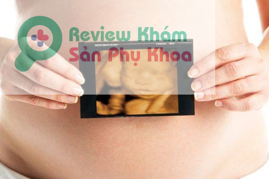 Hình ảnh siêu âm 4D thai 22 tuần: Bé yêu đã hình thành như thế nào