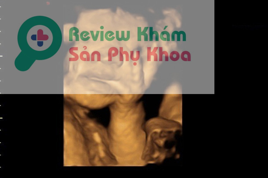 Góc mặt của em bé qua hình ảnh siêu âm 4D thai 24 tuần