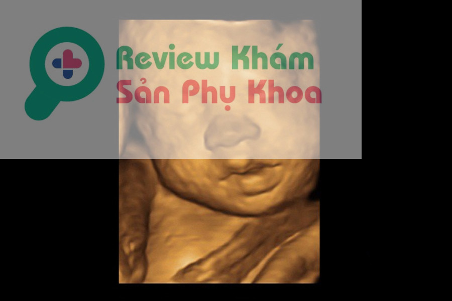 Hình ảnh siêu âm 4D thai 24 tuần của bé gái