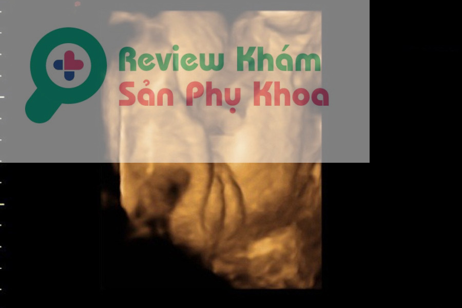 Hình ảnh siêu âm 4D thai 24 tuần của bé trai