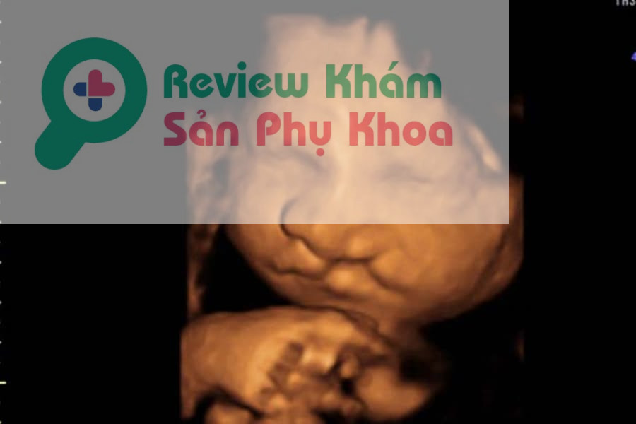 Phát hiện dị tật sứt môi của thai nhi thông qua siêu âm 4D
