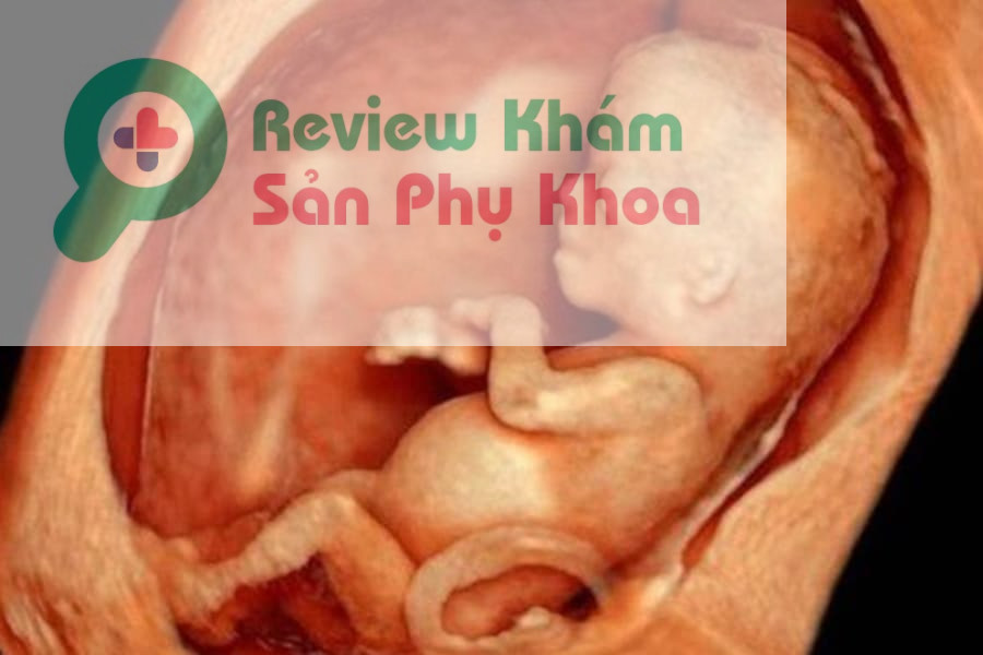 Ngày càng nhiều mẹ bầu yêu thích và lựa chọn siêu âm 4D vì có thể thấy hình ảnh bé sắc nét, rõ ràng