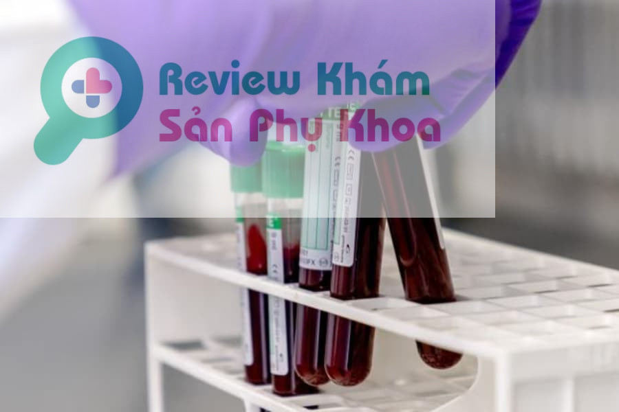Thực hiện xét nghiệm triSure NIPT tại tổ hợp y tế MEDIPLUS giúp giảm 15% số ca bị bỏ sót, giảm từ 25 - 30 lần số ca cần chọc ối "oan”