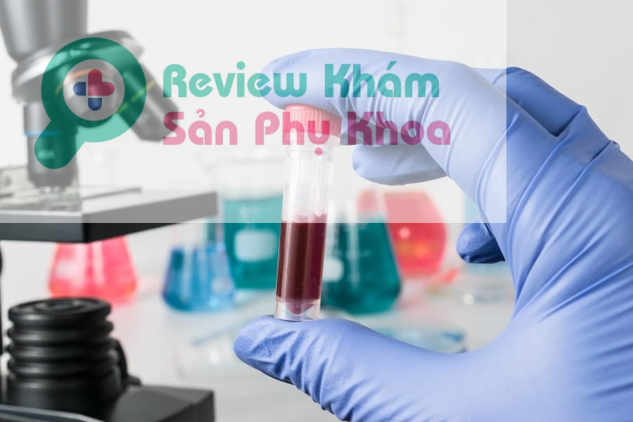 So sánh các gói xét nghiệm NIPT? Cái nào tốt hơn