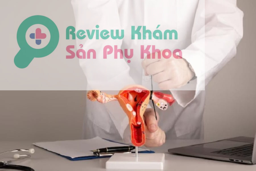 Chi phí triệt sản nữ