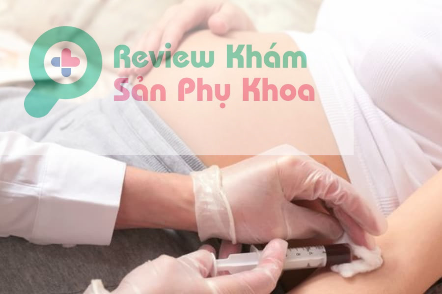 Khi nào cần làm xét nghiệm NIPT? Làm xét nghiệm ở đâu tốt?