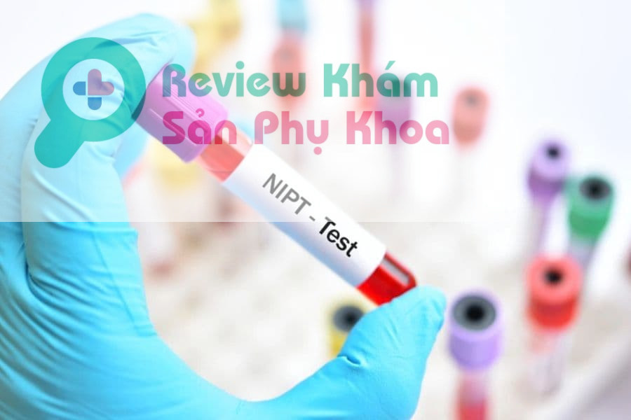 Làm double test rồi có cần làm nipt không?