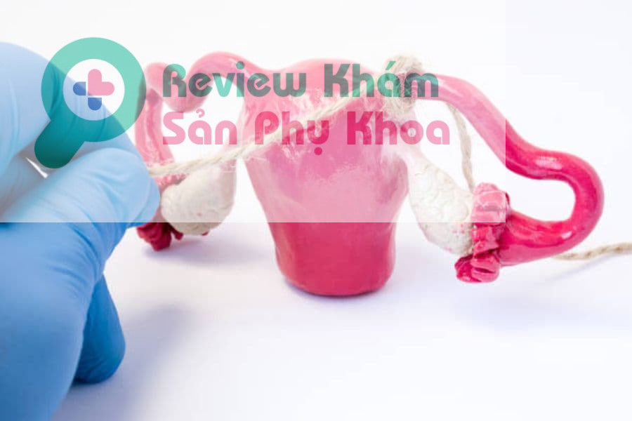 Sau khi sinh thường từ 24 - 36 giờ là có thể thắt ống dẫn trứng