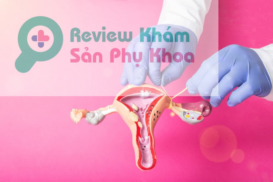 Triệt sản nữ: Nên làm hay không?