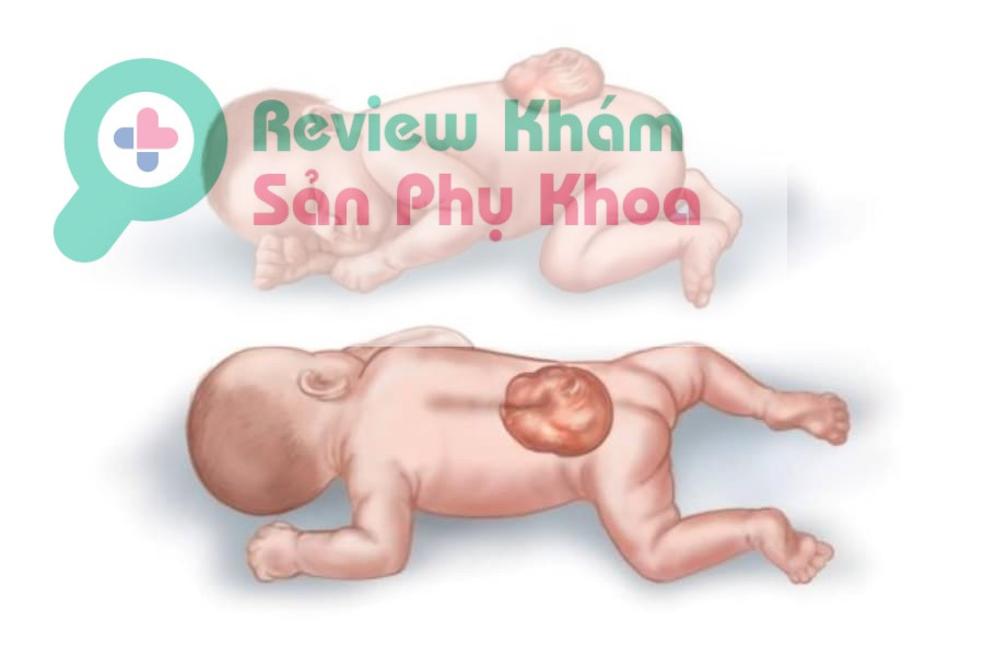 Xét nghiệm Double test là phương pháp sàng lọc thường quy đối với các mẹ bầu trong thai kỳ nhằm sàng lọc đánh giá nguy cơ dị tật thai nhi có thể gặp phải