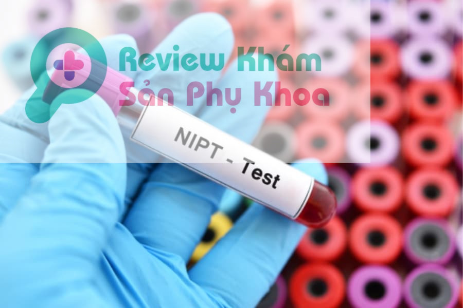 Có nên xét nghiệm NIPT không?