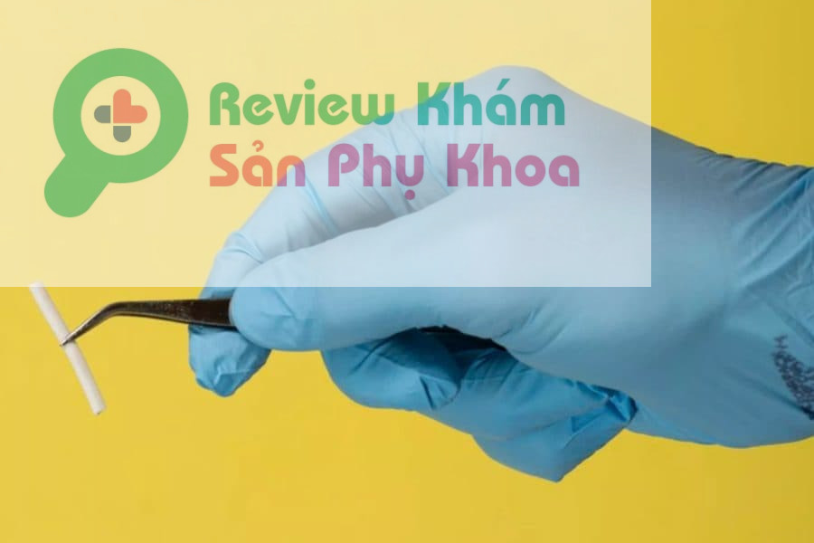 Cấy que tránh thai có thực sự an toàn không?
