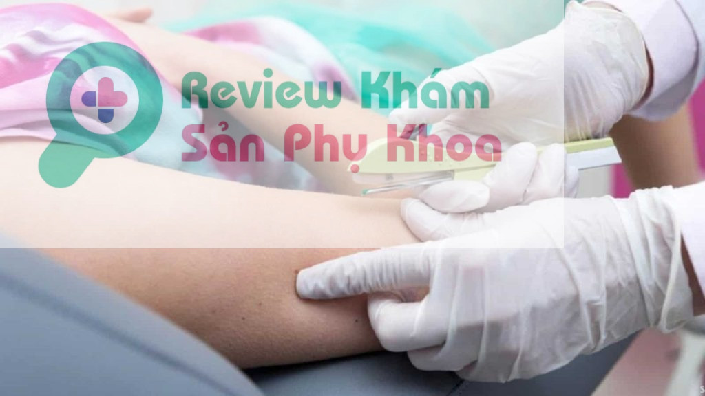 Cấy que tránh thai và những tác dụng hữu ích