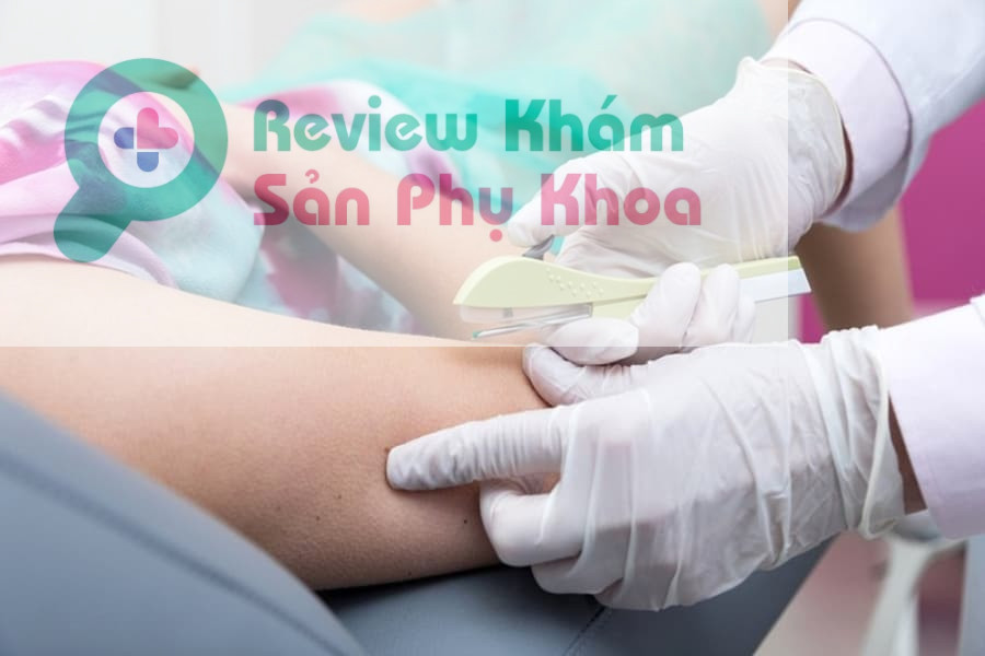 Cấy que tránh thai không phải thủ thuật khó nhưng cũng đòi hỏi những tiêu chuẩn cơ bản để đảm bảo quá trình diễn ra an toàn, hiệu quả và tránh tình trạng nhiễm trùng,...