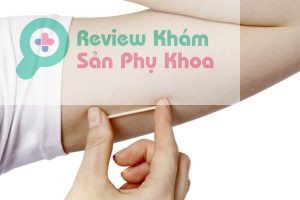 Những điều cần lưu ý về cấy que tránh thai