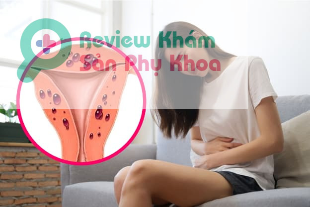 Chảy máu bất thường ngoài chu kỳ kinh nguyệt cần lưu ý điều gì?