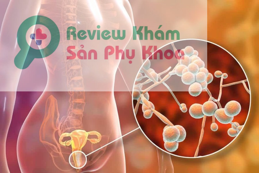 Nổi mẩn đỏ sau khi quan hệ