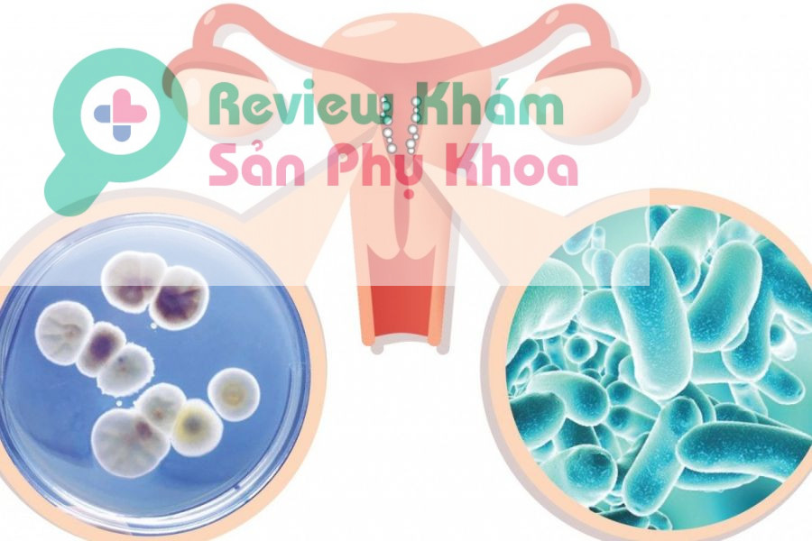 Sau khi quan hệ bị ngứa và ra huyết trắng