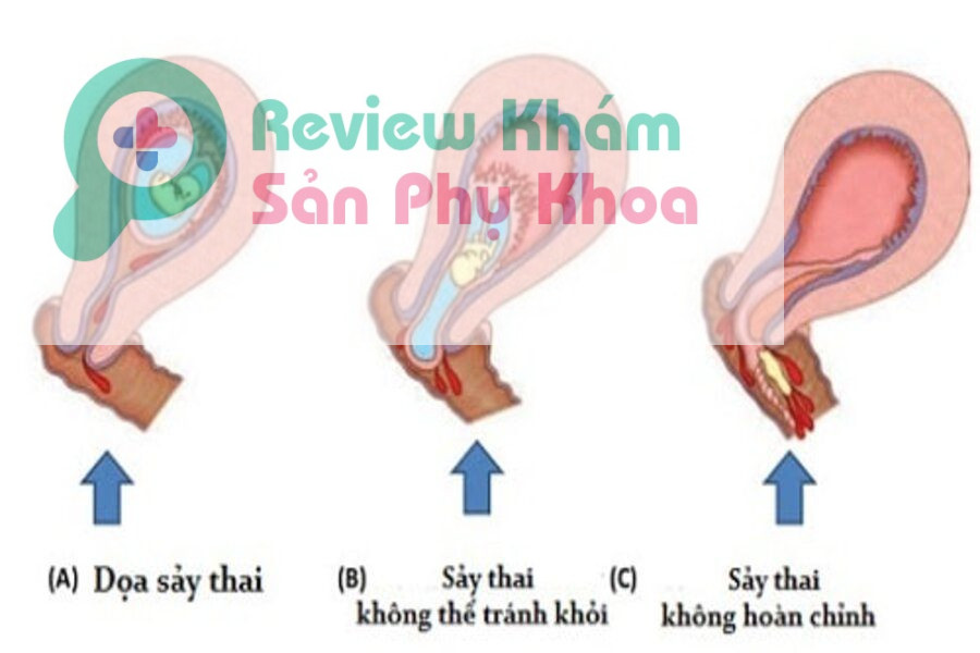 2 tháng đầu mang thai quan hệ được không?