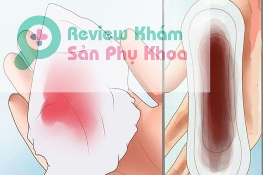 mang thai 3 tháng đầu quan hệ bị ra máu