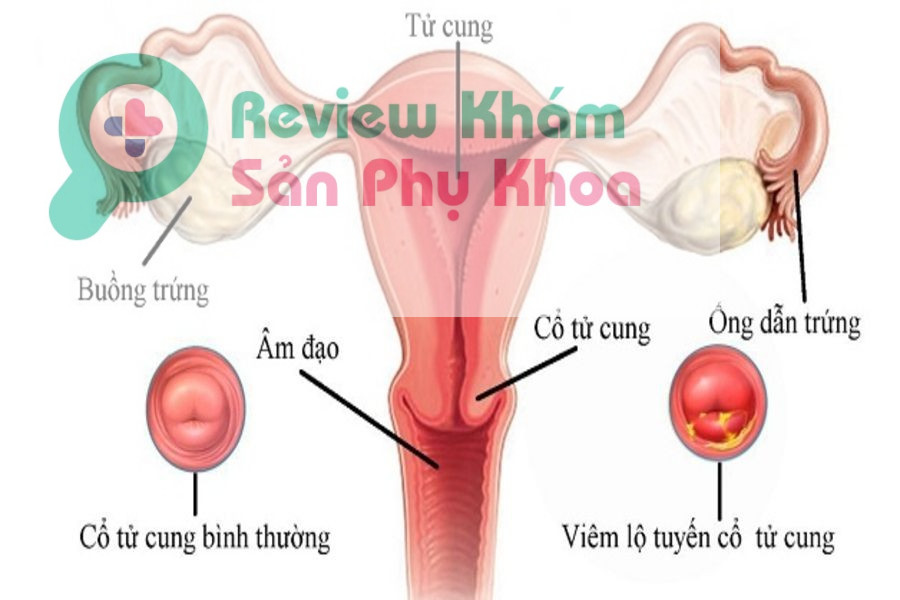 mang thai tháng thứ 6 quan hệ bị ra máu