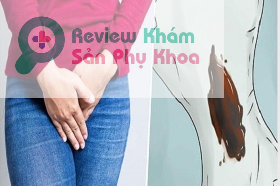 ra khí hư màu nâu có mùi hôi