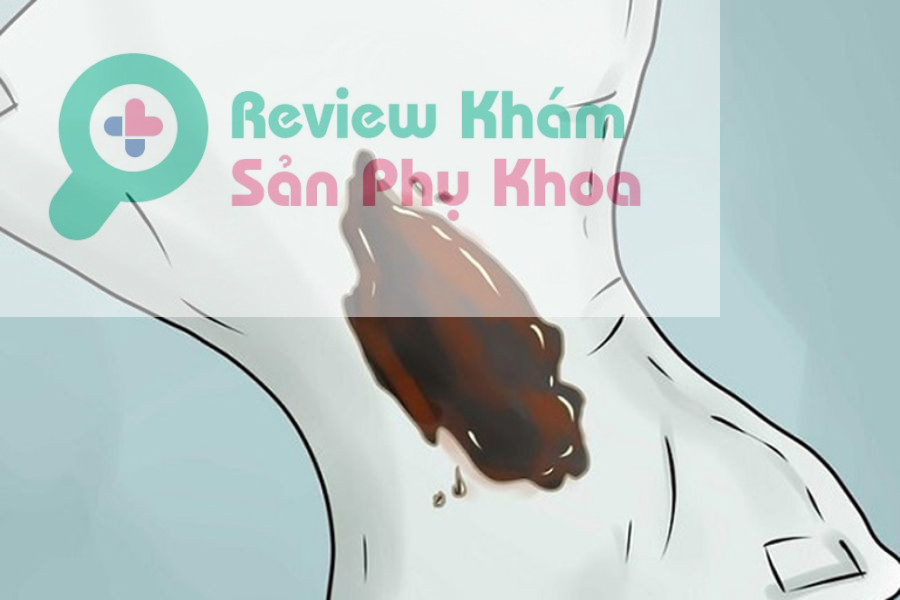 ra khí hư màu nâu có mùi hôi